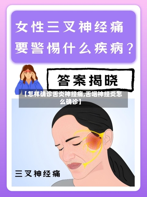 【怎样确诊舌炎神经痛,舌咽神经炎怎么确诊】-第1张图片