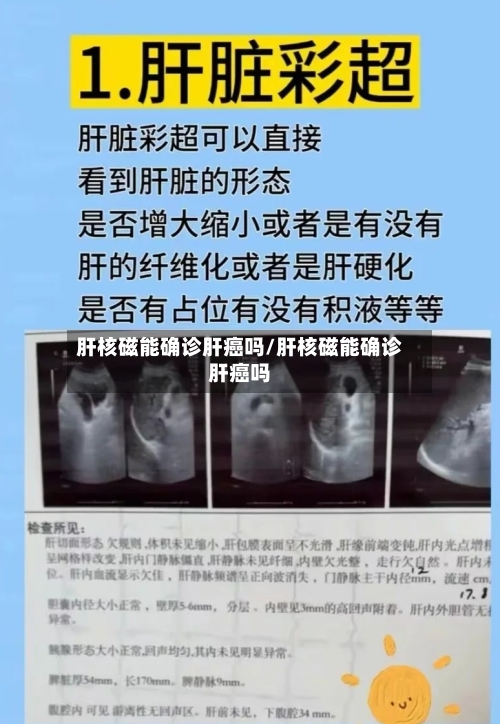 肝核磁能确诊肝癌吗/肝核磁能确诊肝癌吗-第1张图片
