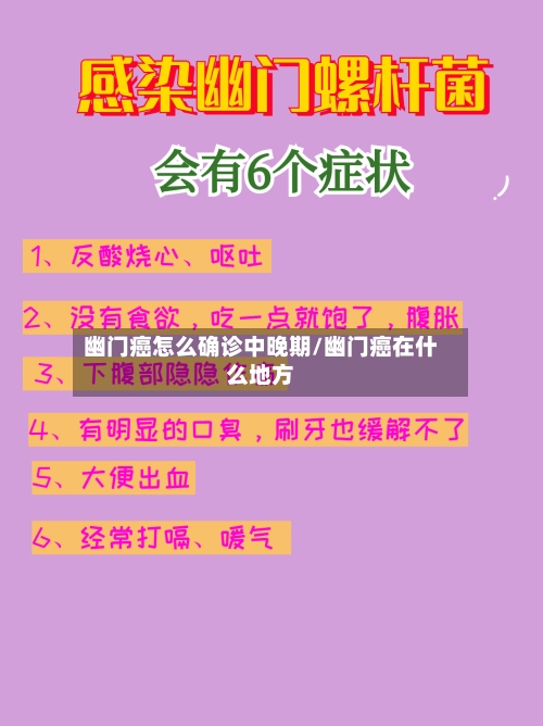幽门癌怎么确诊中晚期/幽门癌在什么地方-第2张图片