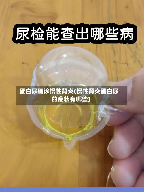 蛋白尿确诊慢性肾炎(慢性肾炎蛋白尿的症状有哪些)-第1张图片